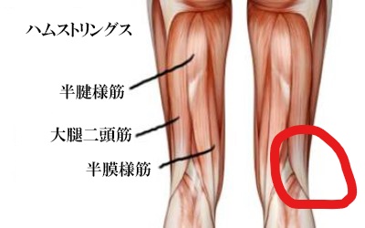 膝裏外側の痛み